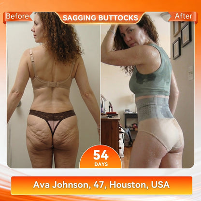 🏆Ends Today: 70% OFF! Keepfity® 𝐌𝐨𝐫𝐢𝐧𝐠𝐚 & 𝐁𝐞𝐫𝐛𝐞𝐫𝐢𝐧𝐞 4‑In‑1 Micro‑Particle Sculpting & Fat‑Burn Shorts