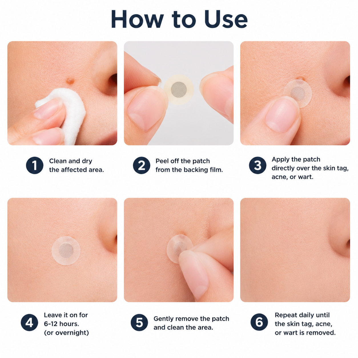 ✨Keepfity® 2-in-1 Microneedle & Hydrocolloid Patch🍀| Removes Raised Moles, Acne, Flat Warts & Skin Tags | Helps Improve Wrinkles, Scars & Blemishes | Invisible Patches for Face & Body