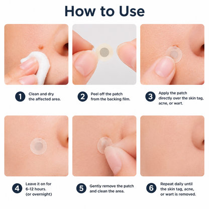 ✨Keepfity® 2-in-1 Microneedle & Hydrocolloid Patch🍀| Removes Raised Moles, Acne, Flat Warts & Skin Tags | Helps Improve Wrinkles, Scars & Blemishes | Invisible Patches for Face & Body