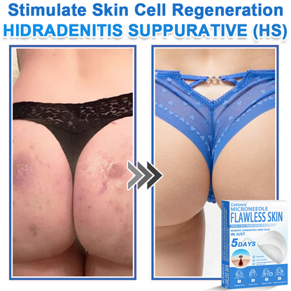 ✅Keepfity® 2-in-1 Microneedle & Hydrocolloid Patch | Raised Moles,Acne,  Flat Warts & Skin Tags Remover | Improves Wrinkles, Scars & Blemishes | Invisible Pimple Patches for Face & Body