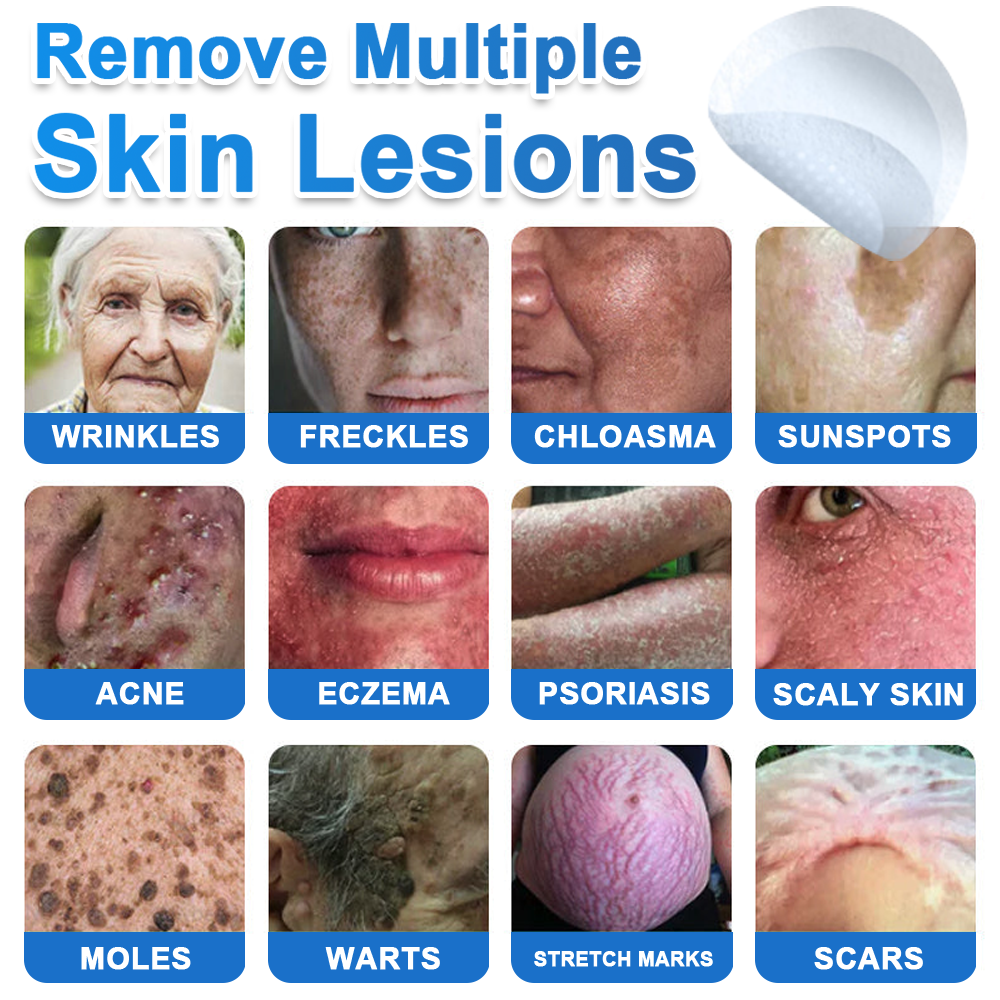 ✅Keepfity® 2-in-1 Microneedle & Hydrocolloid Patch | Raised Moles,Acne,  Flat Warts & Skin Tags Remover | Improves Wrinkles, Scars & Blemishes | Invisible Pimple Patches for Face & Body
