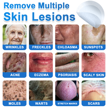 ✅Keepfity® 2-in-1 Microneedle & Hydrocolloid Patch | Raised Moles,Acne,  Flat Warts & Skin Tags Remover | Improves Wrinkles, Scars & Blemishes | Invisible Pimple Patches for Face & Body