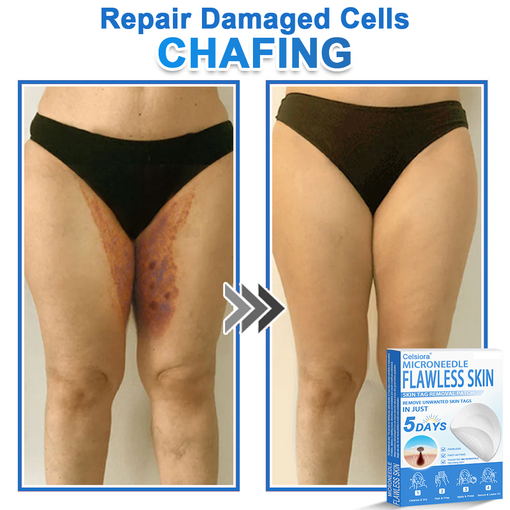 ✅Keepfity® 2-in-1 Microneedle & Hydrocolloid Patch | Raised Moles,Acne,  Flat Warts & Skin Tags Remover | Improves Wrinkles, Scars & Blemishes | Invisible Pimple Patches for Face & Body