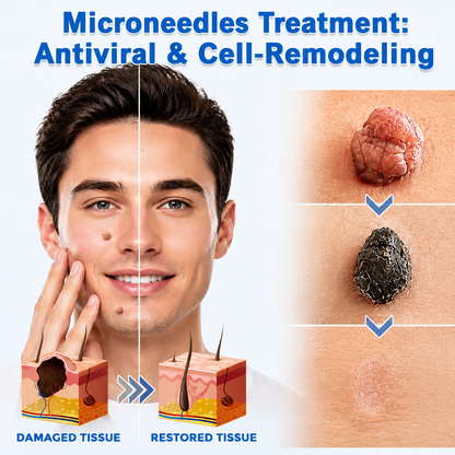 ✨Keepfity® 2-in-1 Microneedle & Hydrocolloid Patch🍀| Removes Raised Moles, Acne, Flat Warts & Skin Tags | Helps Improve Wrinkles, Scars & Blemishes | Invisible Patches for Face & Body