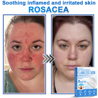 ✅Keepfity® 2-in-1 Microneedle & Hydrocolloid Patch | Raised Moles,Acne,  Flat Warts & Skin Tags Remover | Improves Wrinkles, Scars & Blemishes | Invisible Pimple Patches for Face & Body
