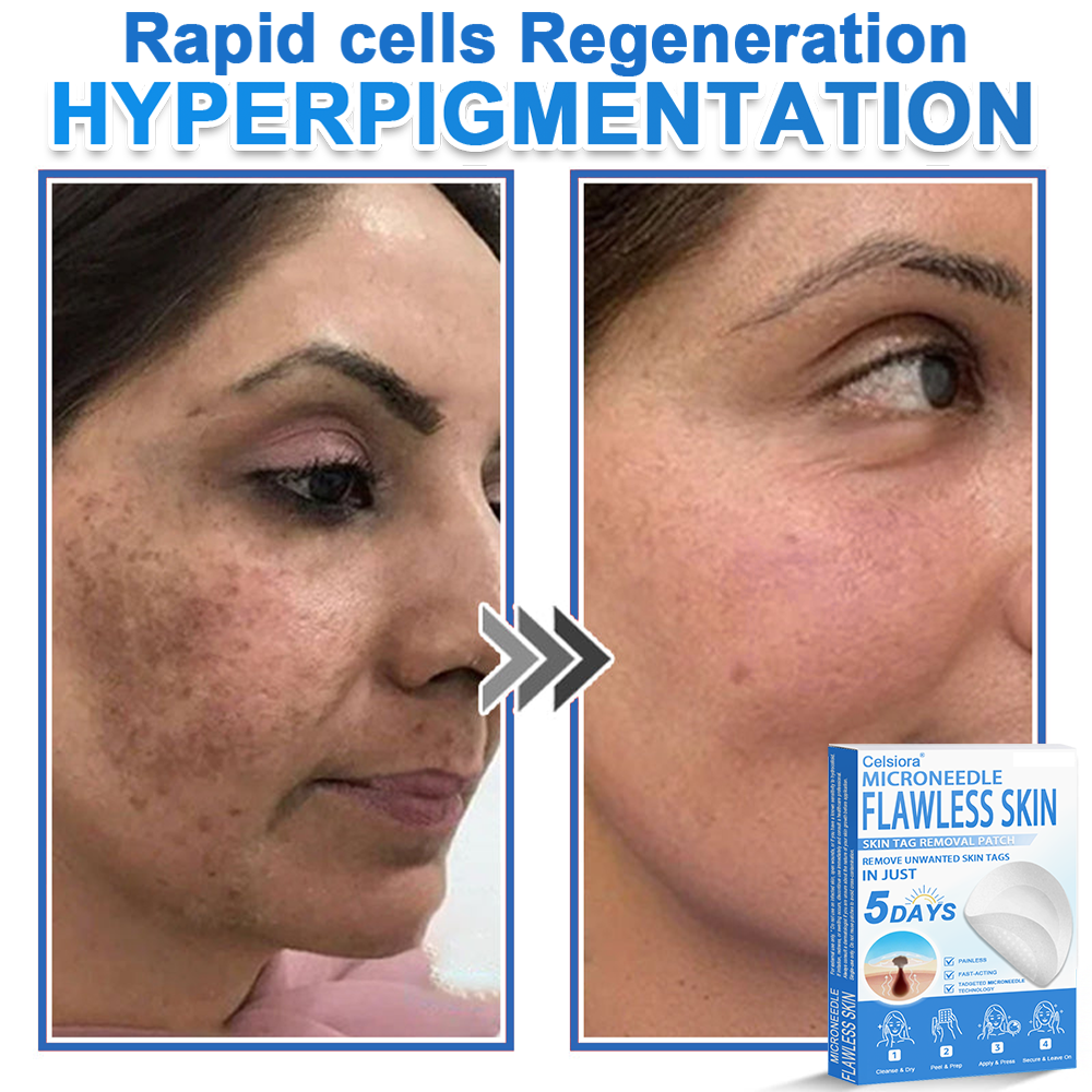 ✅Keepfity® 2-in-1 Microneedle & Hydrocolloid Patch | Raised Moles,Acne,  Flat Warts & Skin Tags Remover | Improves Wrinkles, Scars & Blemishes | Invisible Pimple Patches for Face & Body