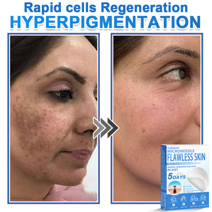 ✅Keepfity® 2-in-1 Microneedle & Hydrocolloid Patch | Raised Moles,Acne,  Flat Warts & Skin Tags Remover | Improves Wrinkles, Scars & Blemishes | Invisible Pimple Patches for Face & Body
